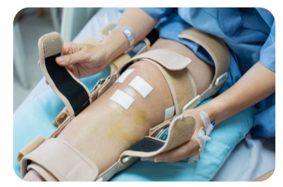 인대재건술-종류