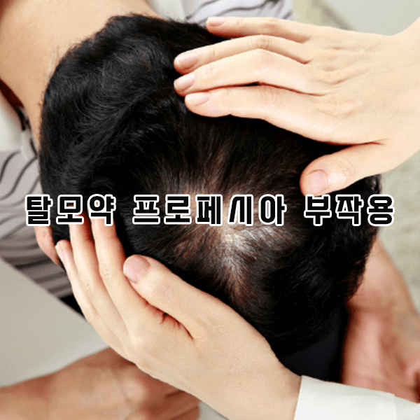 탈모약 프로페시아 부작용
