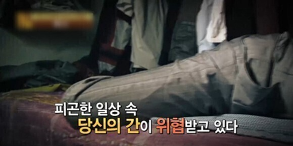 간경화초기증상