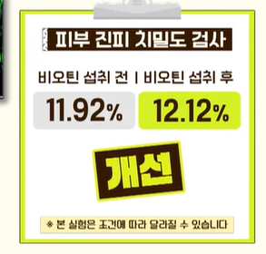 비오틴 효능