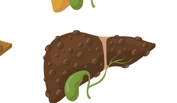 피부와 눈이 노랗게 변하고 복통이 있다면 이 질환 의심해요