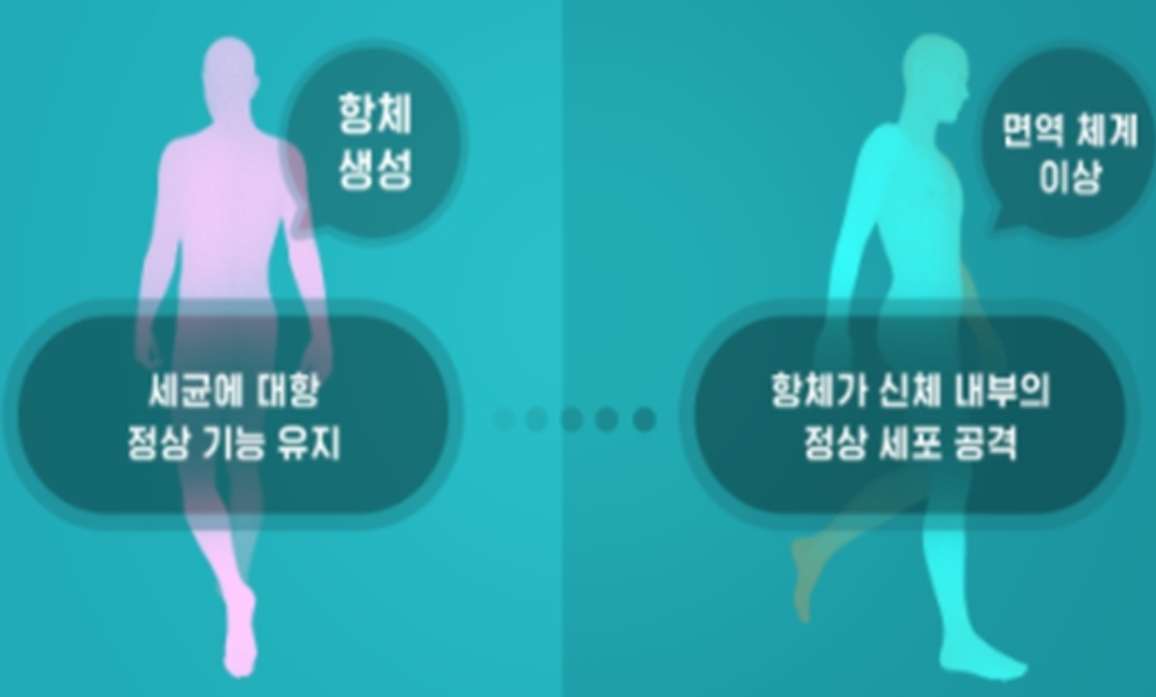 베체트병