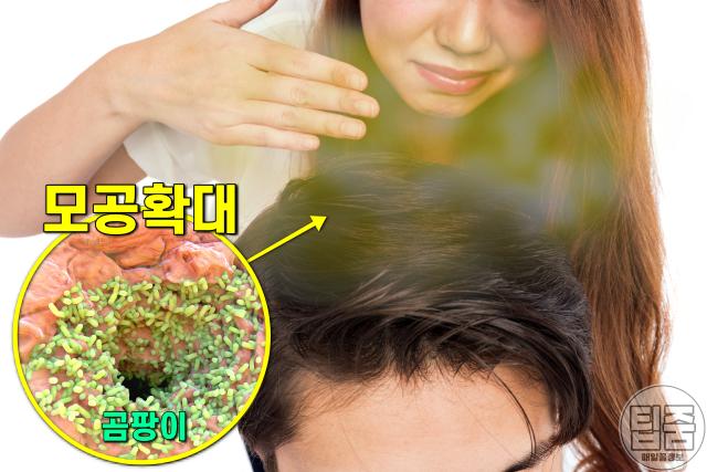 땀 건강 땀 색깔 증상,머리 땀냄새 두피냄새,팁줌