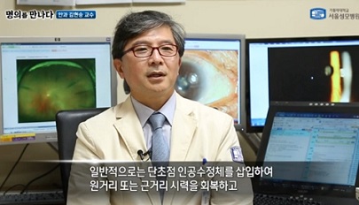 단초점인공수정체