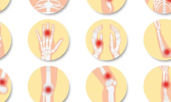 류마티스 관절염의 원인 1