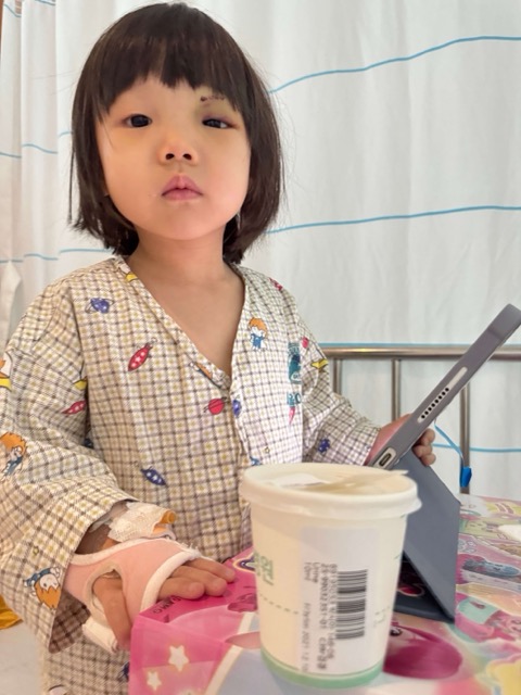 눈 부은 여자아이