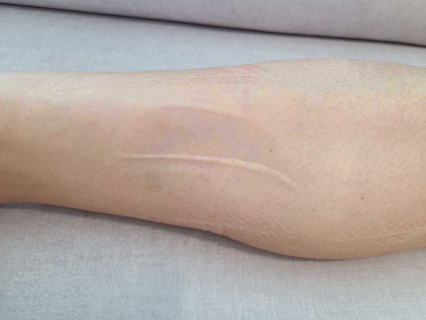 풀리오 종아리 마사지기