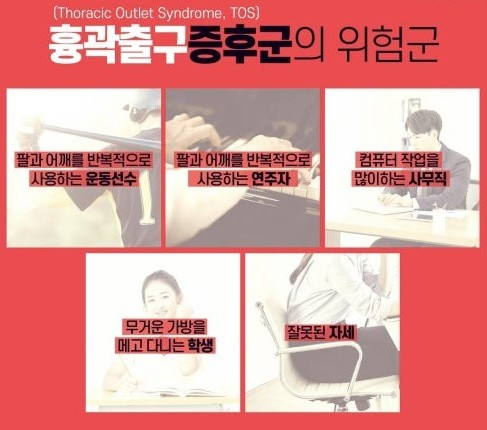 흉곽출구증후군
