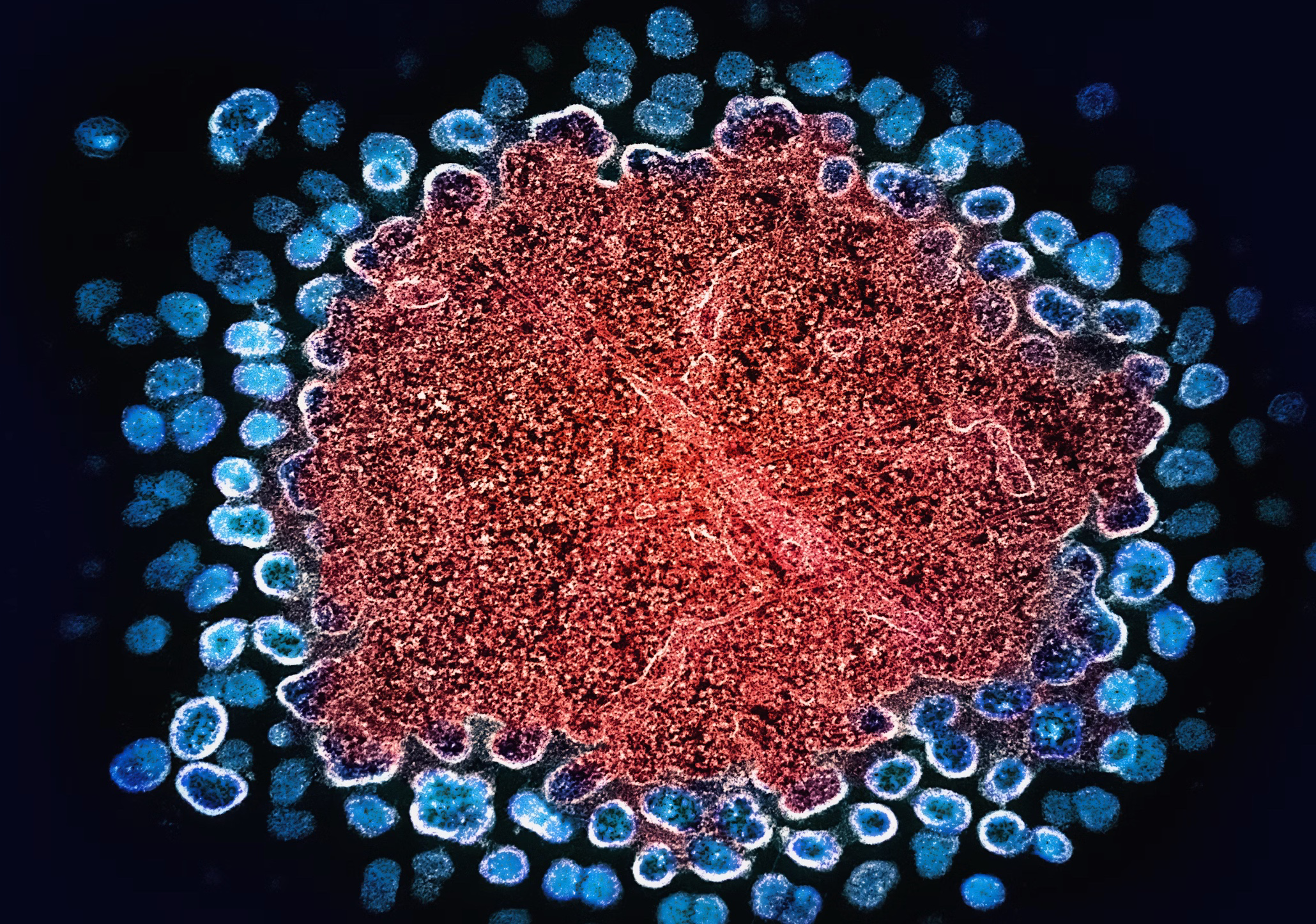 헬리코박터균 제균치료