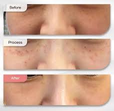 우리동네 잘하는피부과 선택법 |실력 있는 병원 찾는 핵심 포인트 관련사진