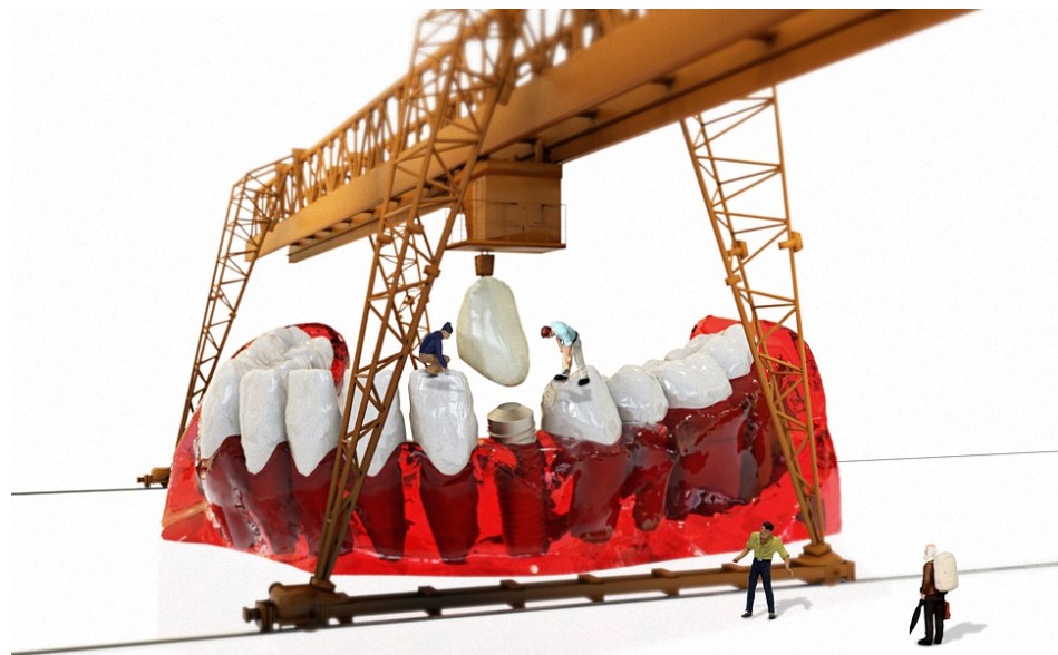 춘천시-임플란트-치과-가격-비용-싼-곳,저렴한-곳,잘하는-곳,유명한-곳-BEST20-추천