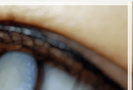 백내장 초기 증상