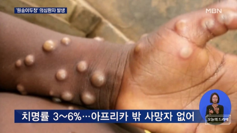 엠포스 게이