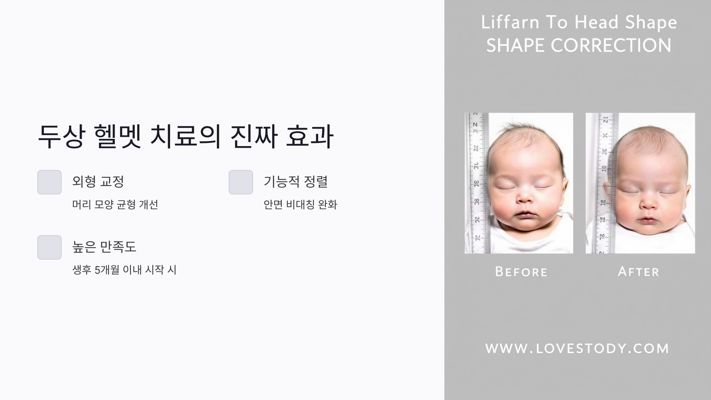 두상 헬멧 비용, 효과 있을까? 가격 비교부터 보험 적용까지