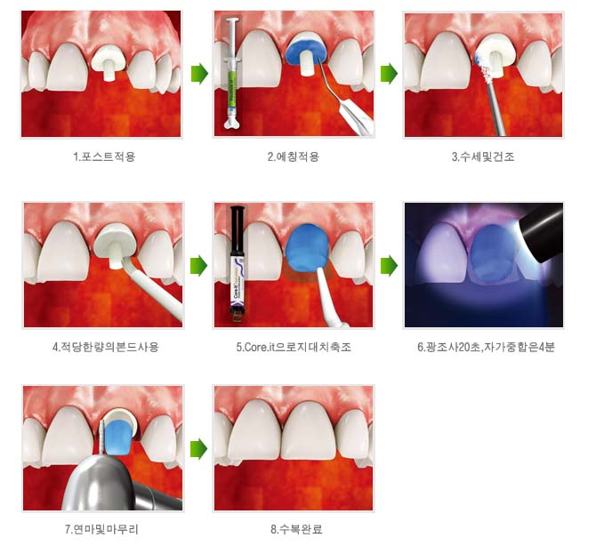 각 단계에서 사용되는 도구와 재료