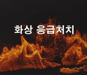 화상 응급처치 방법