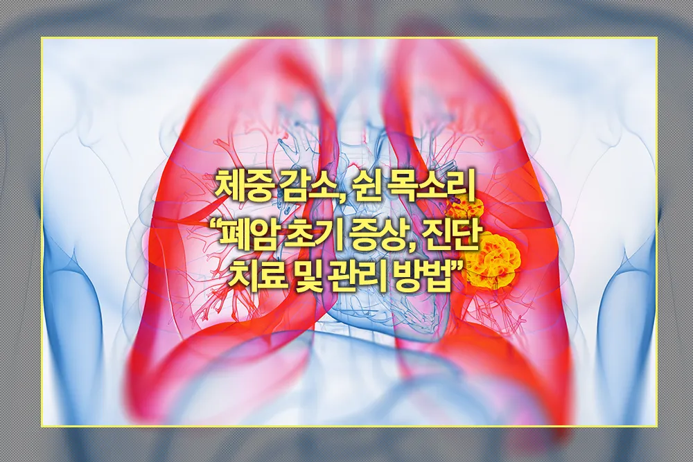 폐암 초기증상 진단 치료