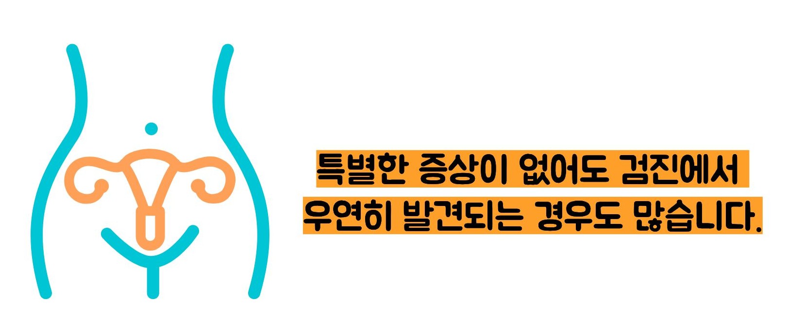 난소 낭종의 증상