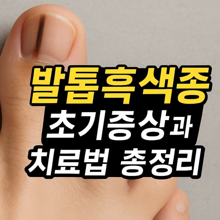 🦶 엄지발톱이 까맣다고? 발톱흑색종 초기증상과 치료법 총정리