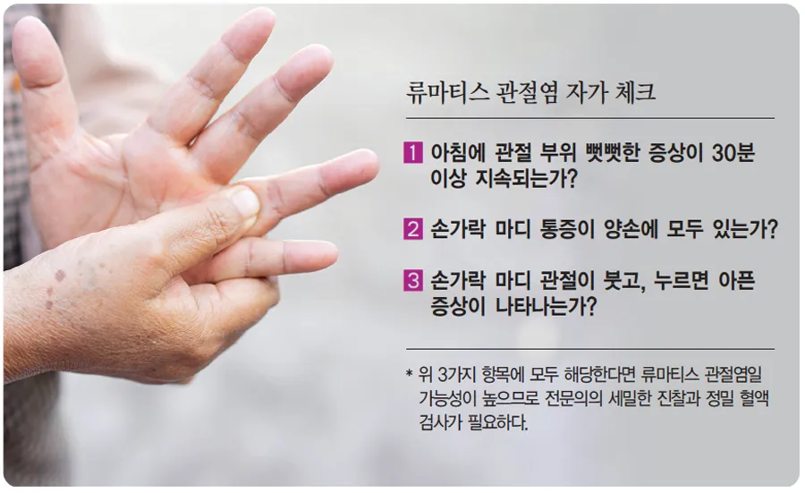 손가락 관절염 증상