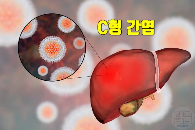 우루사 효능 간영양제 udca 효과 c형간염