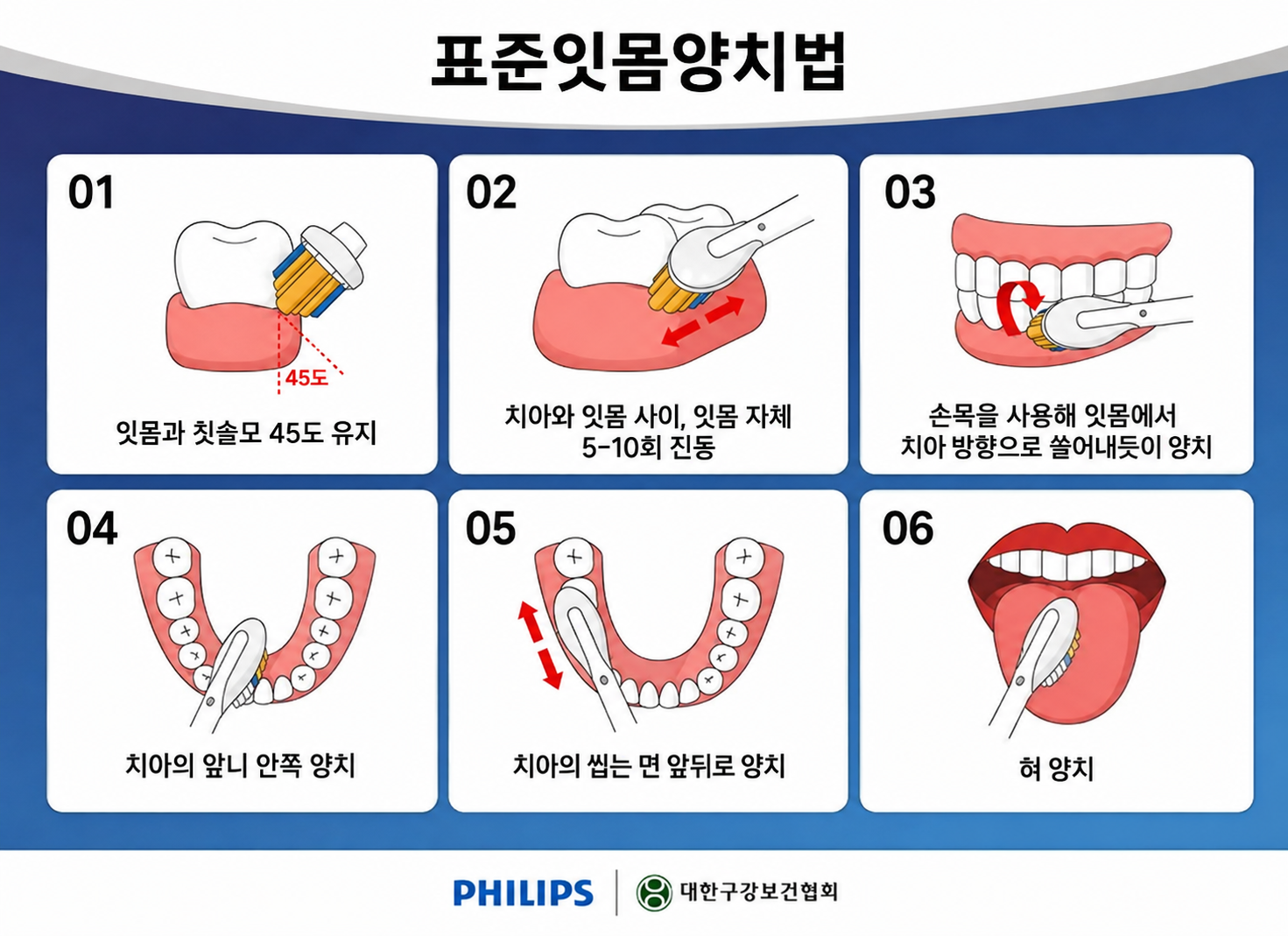 강하게 문지르지 않고 잇몸 결을 따라 부드럽게 쓸어내리는 올바른 양치 동작(회전법/변형 바스법)을 보여주는 가이드 이미지