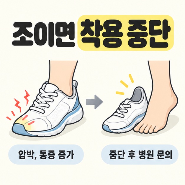 조이면 착용 중단이라는 제목 아래 압박과 통증이 증가한 운동화를 벗은 모습과 중단 후 병원 문의 문구를 보여 주는 그림