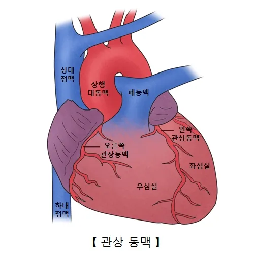 관상동맥 설명이미지