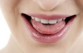 혓바늘 없애는 방법