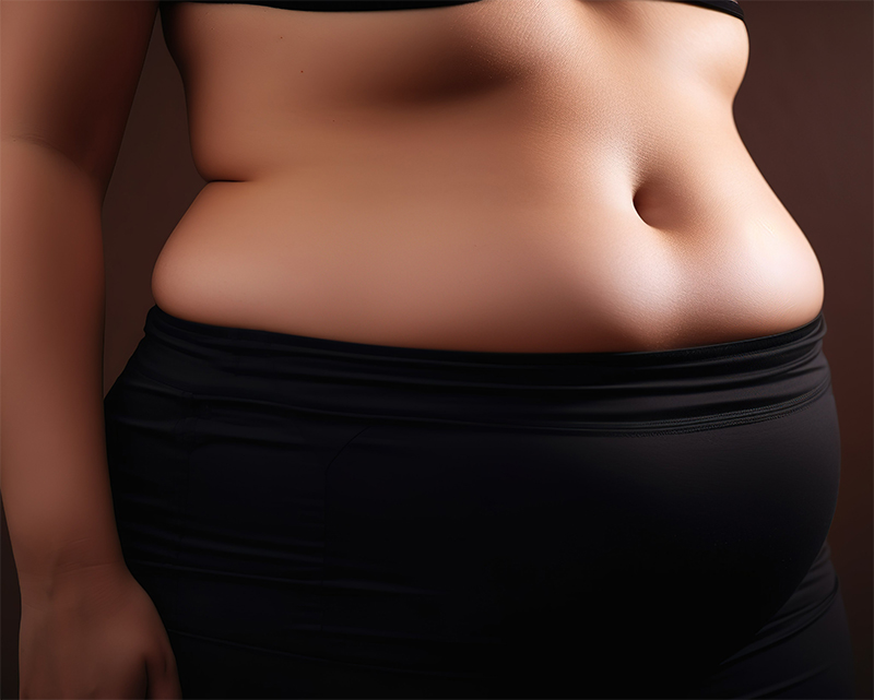 비만, 내장지방