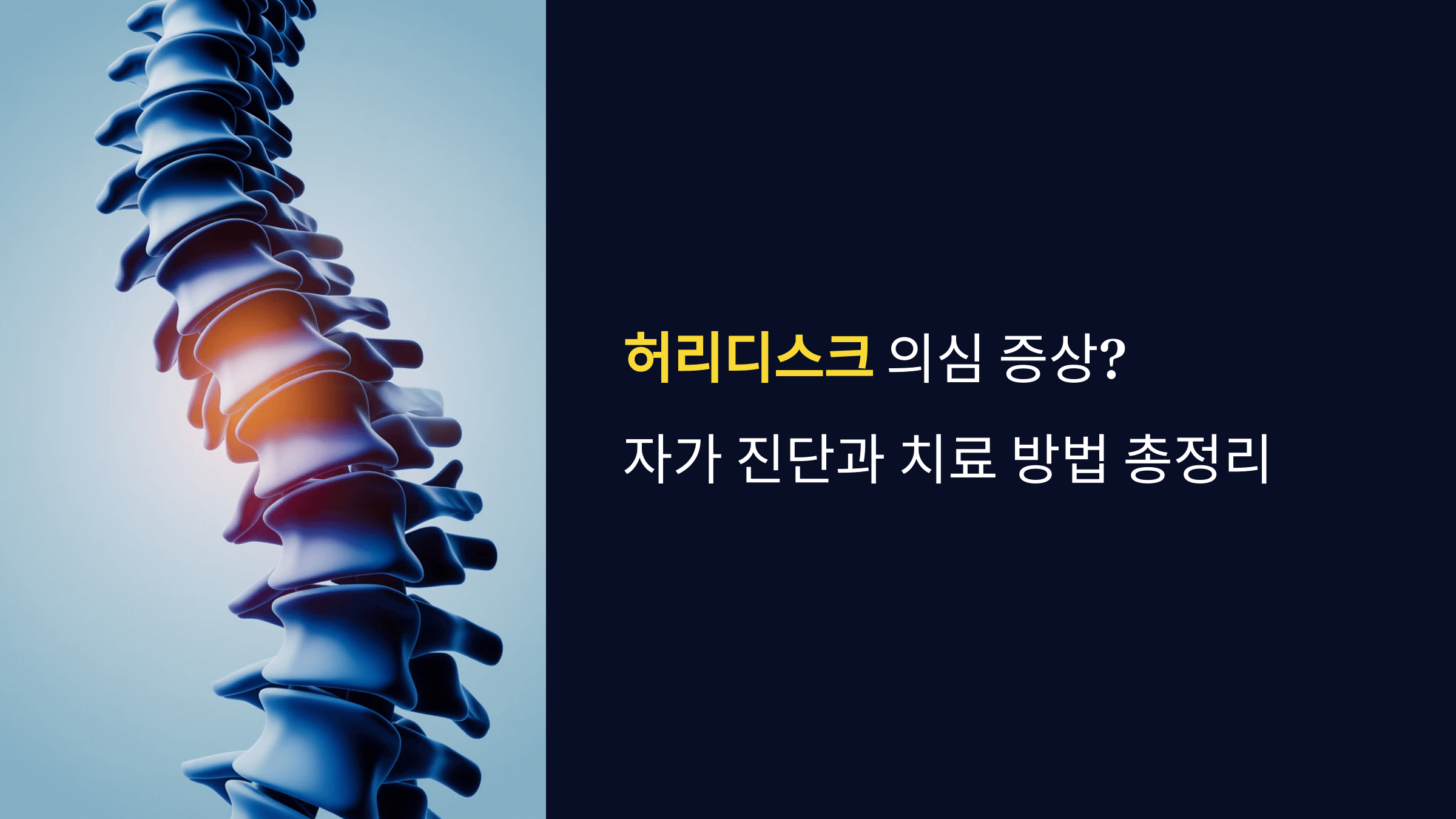 허리디스크 의심 증상? 자가 진단과 치료 방법 총정리