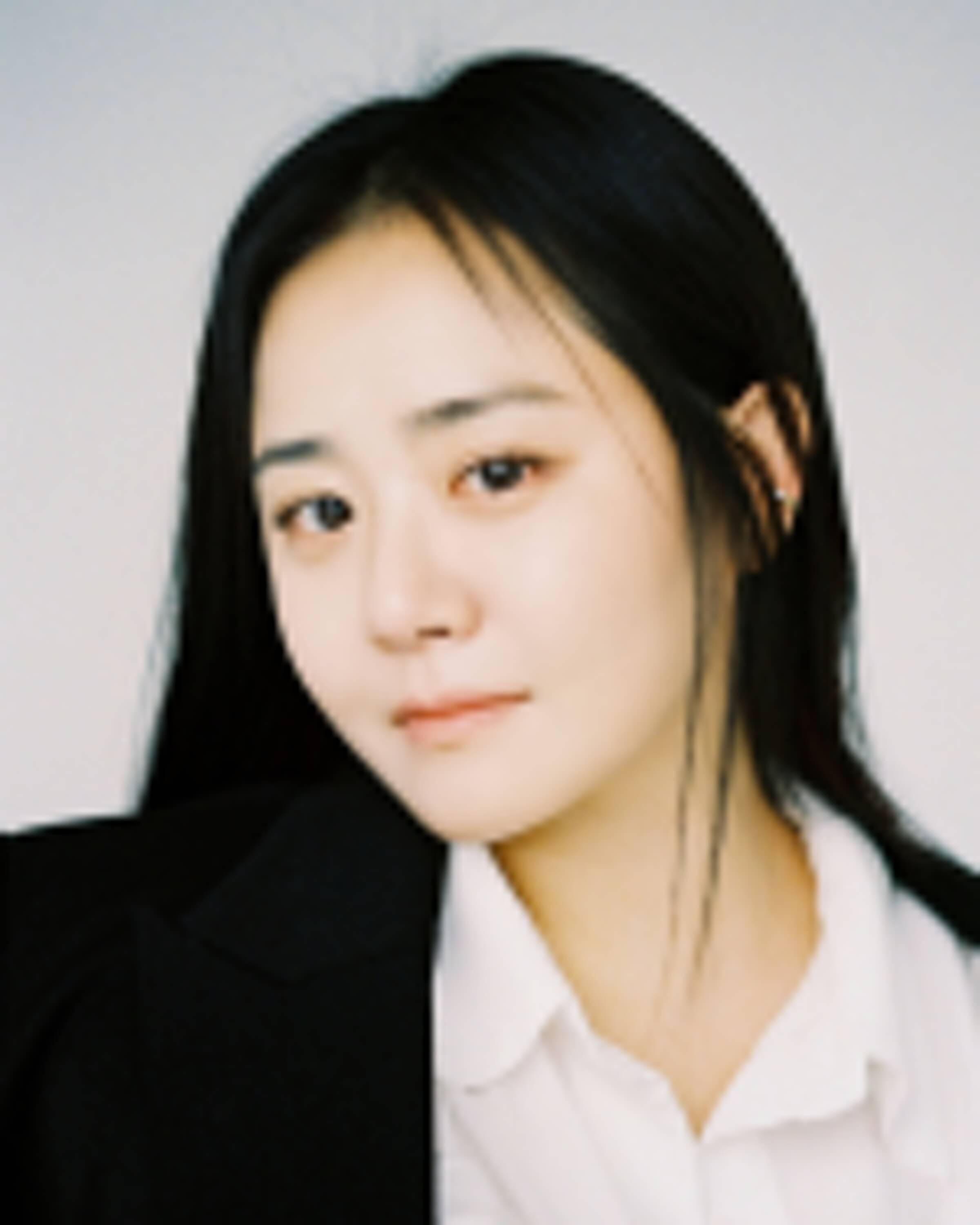 급성구획증후군, 문근영 질환, 급성 구획 증후군 증상, 문근영 수술, 구획증후군 치료, 구획증후군 원인, 구획증후군 완치, 배우 문근영