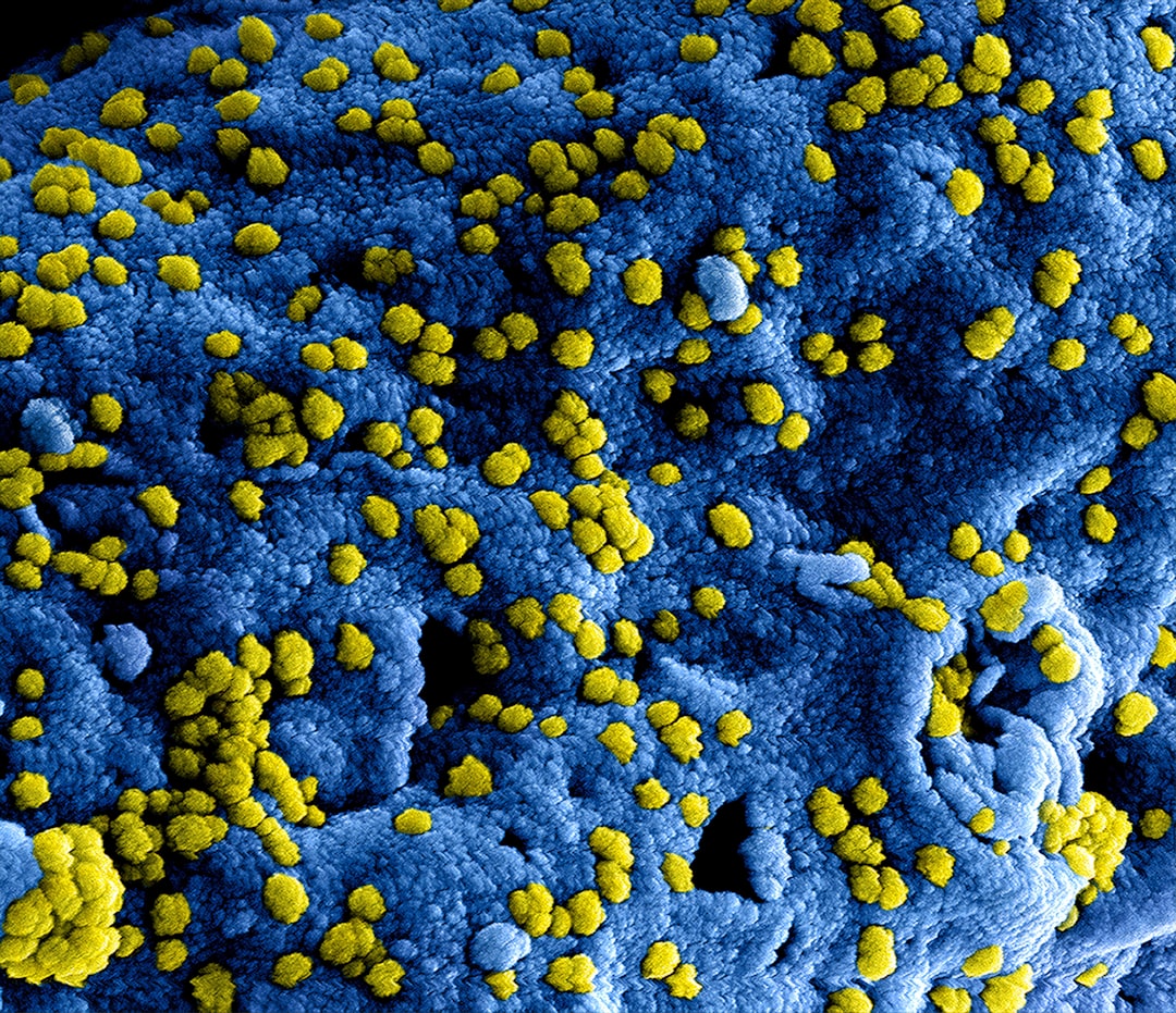 Measles