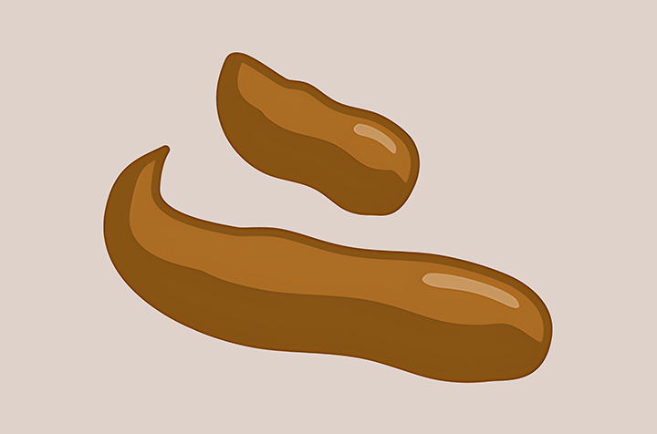 가늘고-길쭉하게-생긴-대변