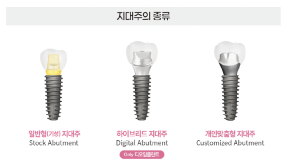 지대주 종류
