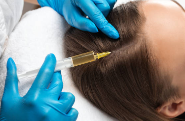 두피 주사
