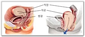 출산 후 자궁수축 기간_8