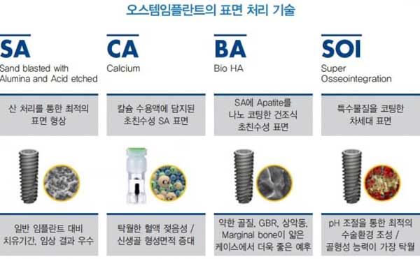 오스템임플란트-가격-후기-실제로-임플란트했던-경험-후기-리뷰