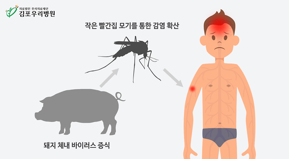일본뇌염 치료방법