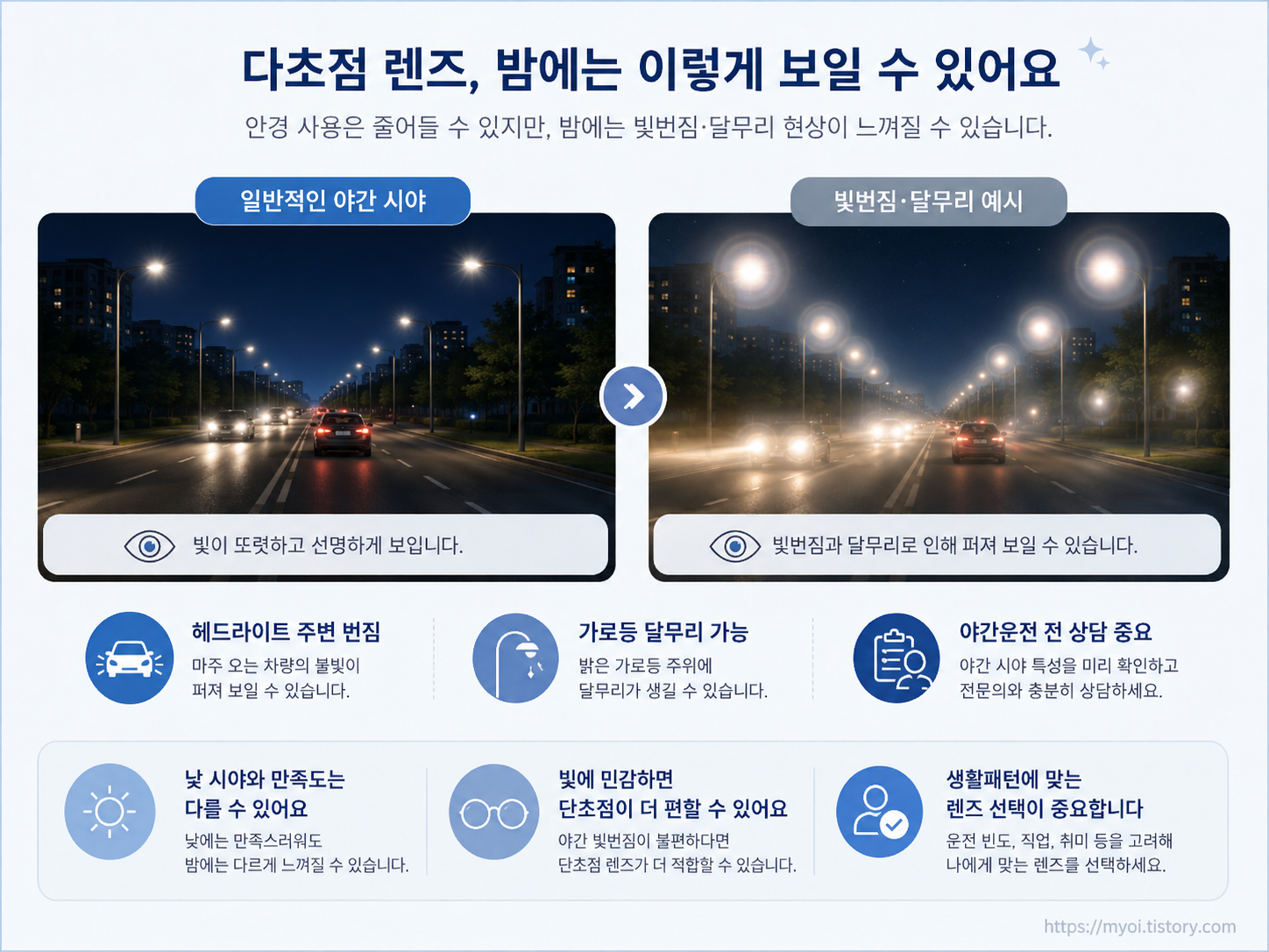백내장 다초점 렌즈 야간 빛번짐 달무리 비교