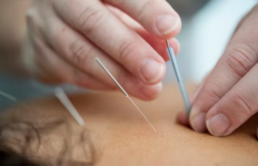 괘상주역의 원리와 근삼침(靳三鍼)의 효과(괘상주역, 근삼침, 임상적용)의 이미지