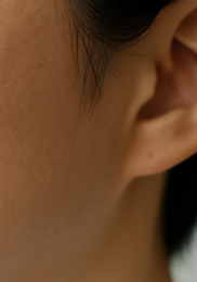 비립종 생기는 이유