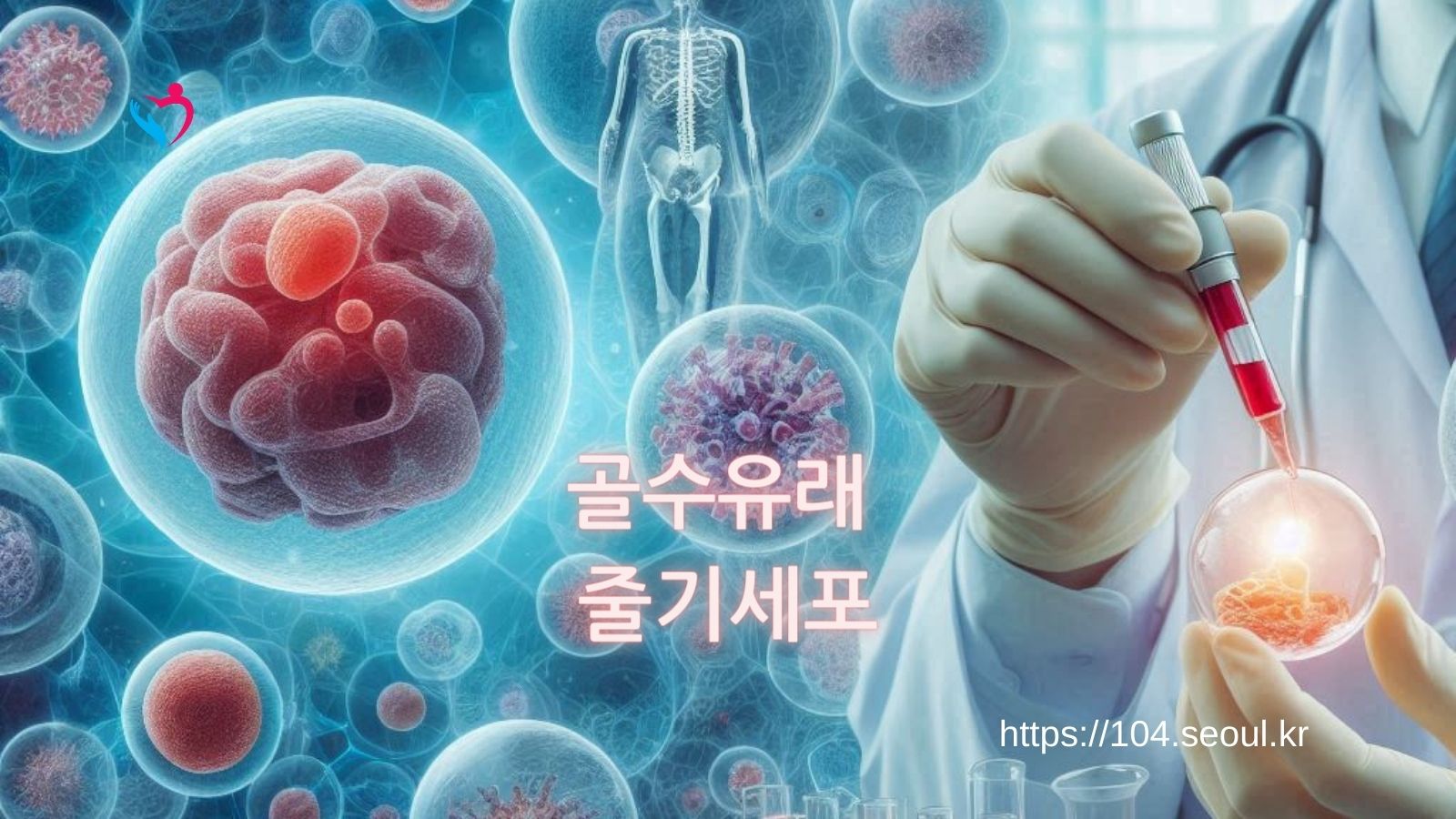 골수유래 줄기세포