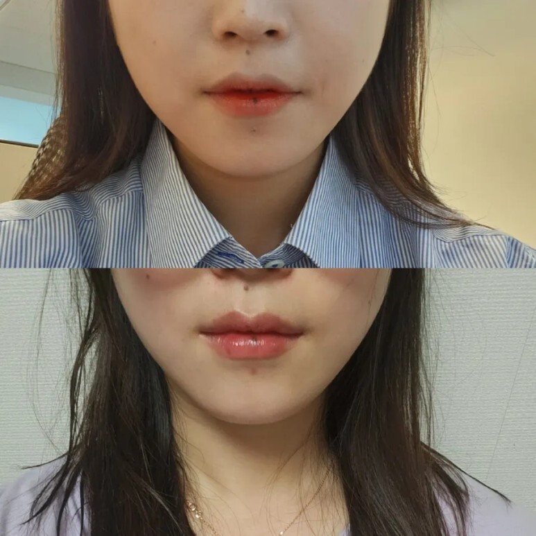 슈링크 유니버스 후기