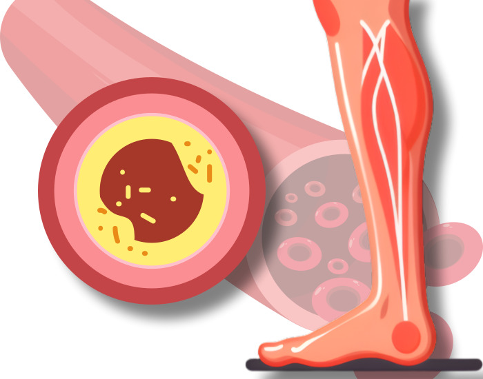 동맥 혈관을 표현한 그림