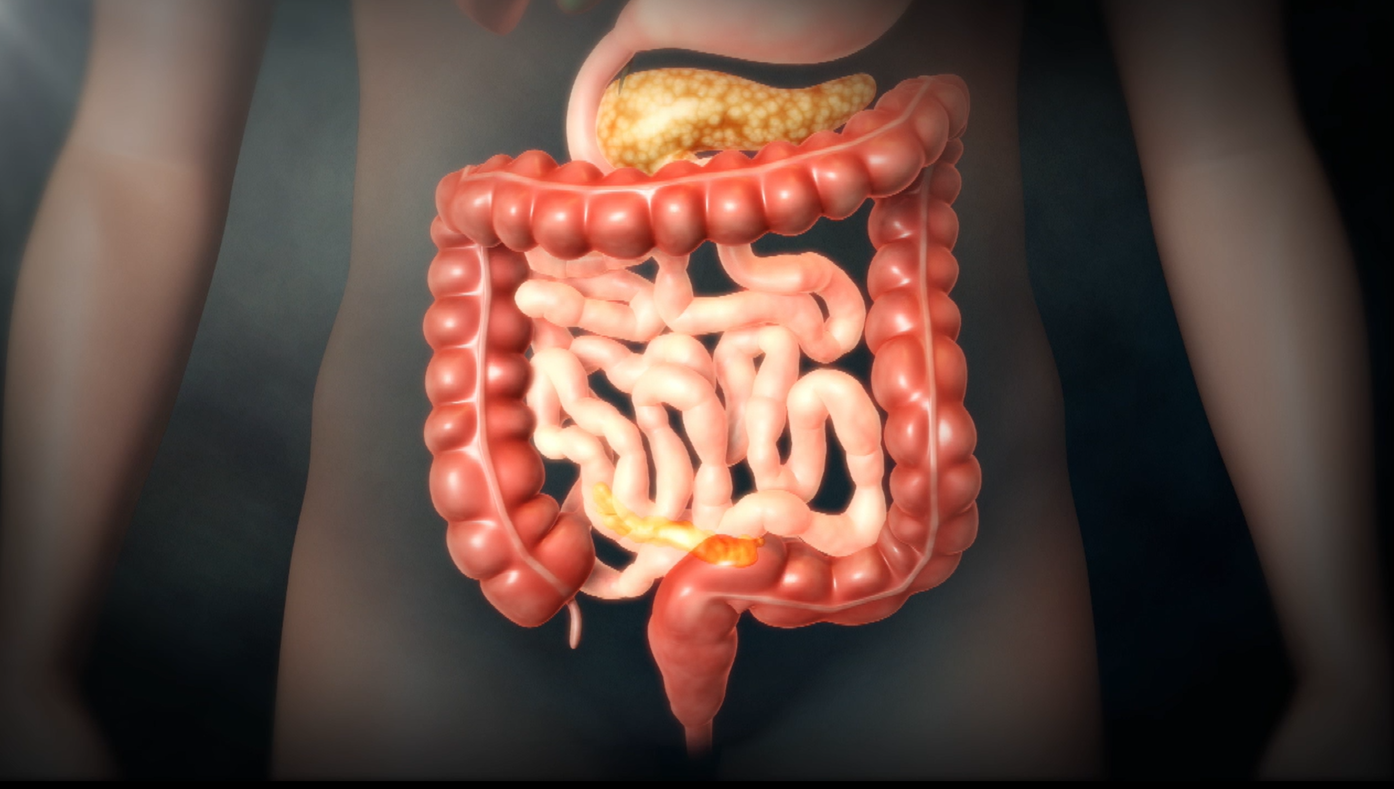 명의 면역력 장