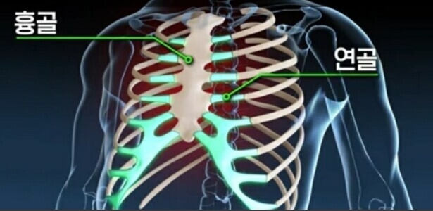 위산역류 흉골위치
