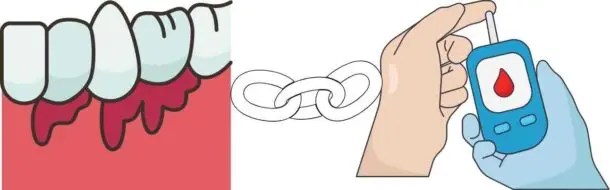 당뇨병과 치주염은 서로 상당한 영향을 미친다.