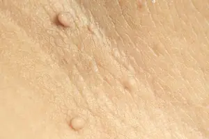 쥐젖