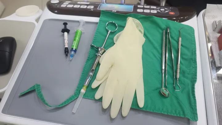 치과 홈메우기 장비